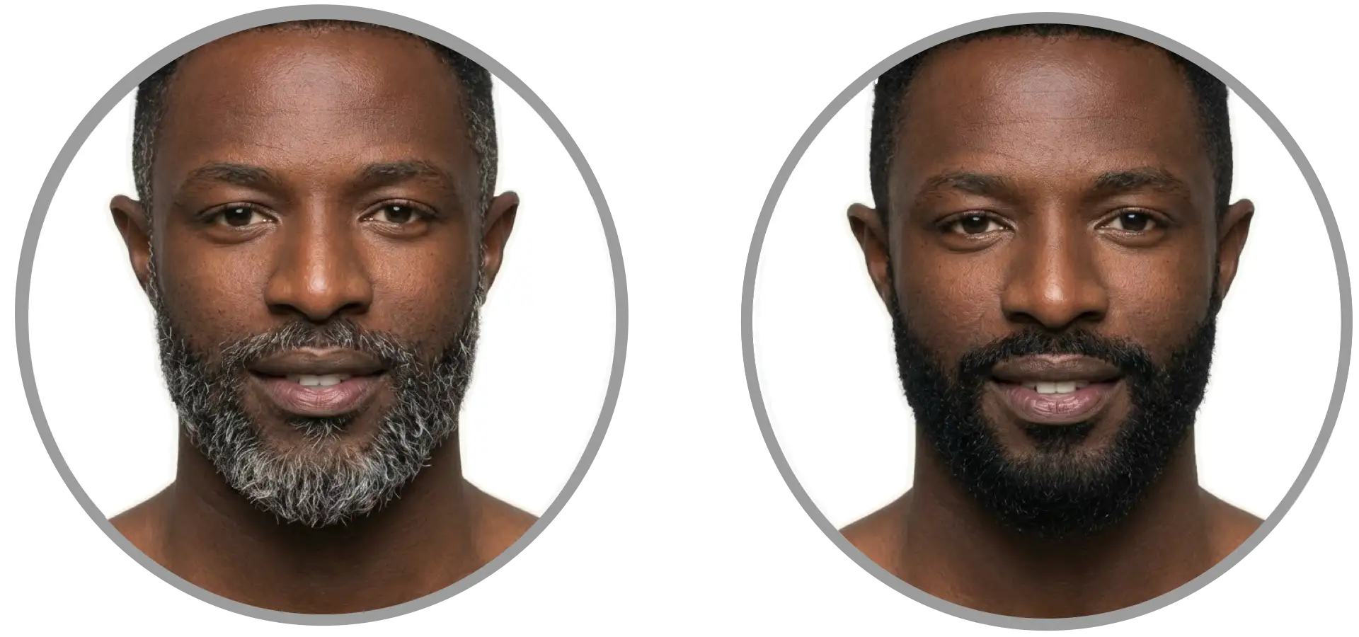 Before and after beard and mustache dye for men—long-lasting color, blends seamlessly, and looks 100% natural. Works in just 7 minutes, with more custom shade selections vs. Just For Men and Simpler Hair Color. Before and after beard and mustache dye for men—long-lasting color, blends seamlessly, and looks 100% natural. Works in just 7 minutes, with more custom shade selections vs. Just For Men and Simpler Hair Color.