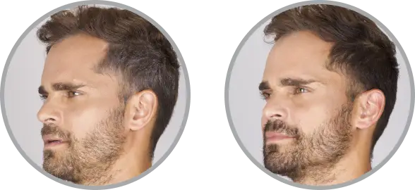 Before and after beard and mustache dye for men—long-lasting color, blends seamlessly, and looks 100% natural. Works in just 7 minutes, with more custom shade selections vs. Just For Men and Simpler Hair Color.