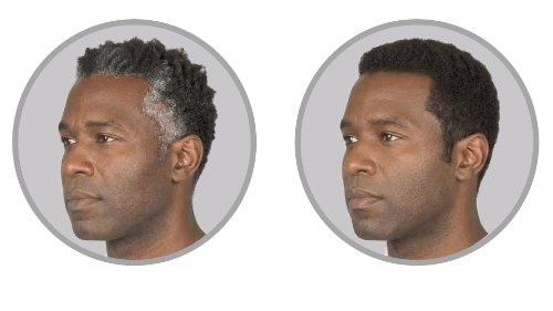 Before and after touch-up hair dye for men—covers only where needed, blending seamlessly.