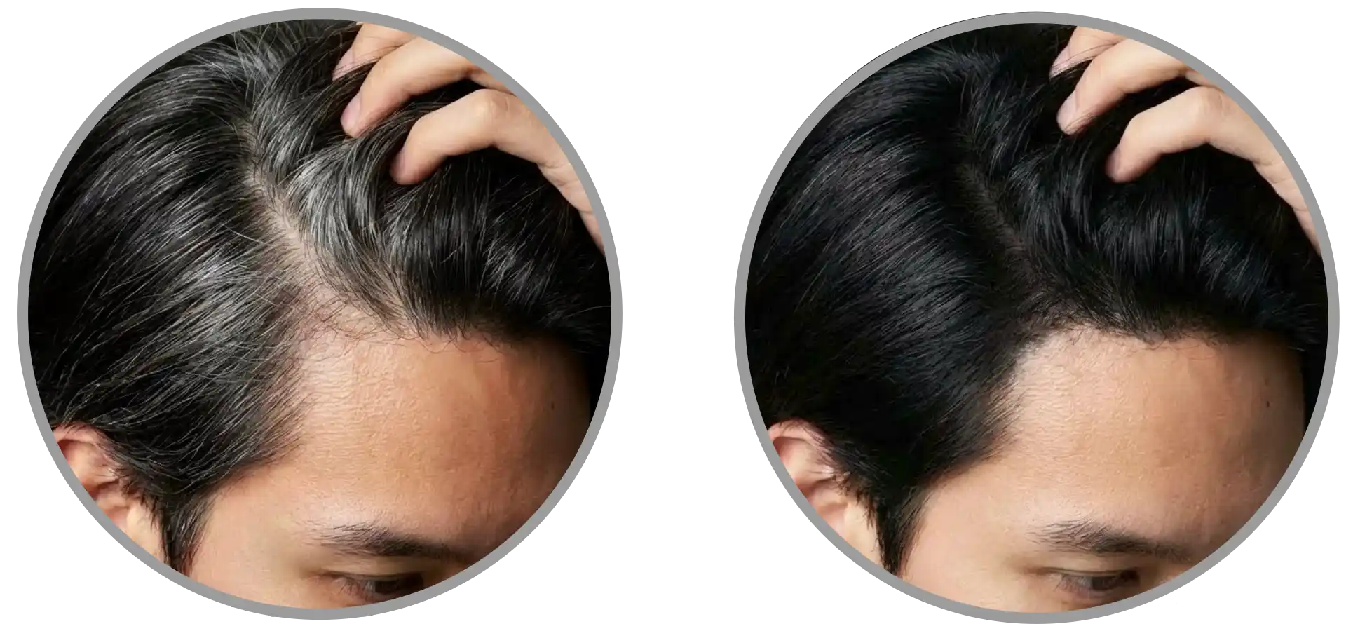 Before and after touch-up hair dye for men—covers only where needed, blending seamlessly with natural color. Works fast, easy to apply, with more shade options vs. Just For Men and Simpler Hair Color Before and after touch-up hair dye for men—covers only where needed, blending seamlessly with natural color. Works fast, easy to apply, with more shade options vs. Just For Men and Simpler Hair Color