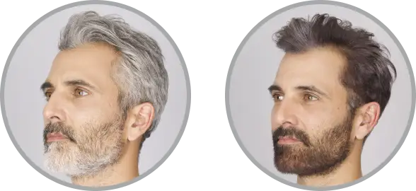 Before and after touch-up hair dye for men—covers only where needed, blending seamlessly with natural color. Works fast, easy to apply, with more shade options vs. Just For Men and Simpler Hair Color