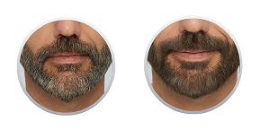 Cleverman