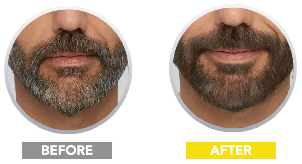 Before and after results of Cleverman full-coverage beard dye. Achieves a natural, even color with a quick 7-minute application. Long-lasting formula, better for sensitive skin, and easy to use at home.