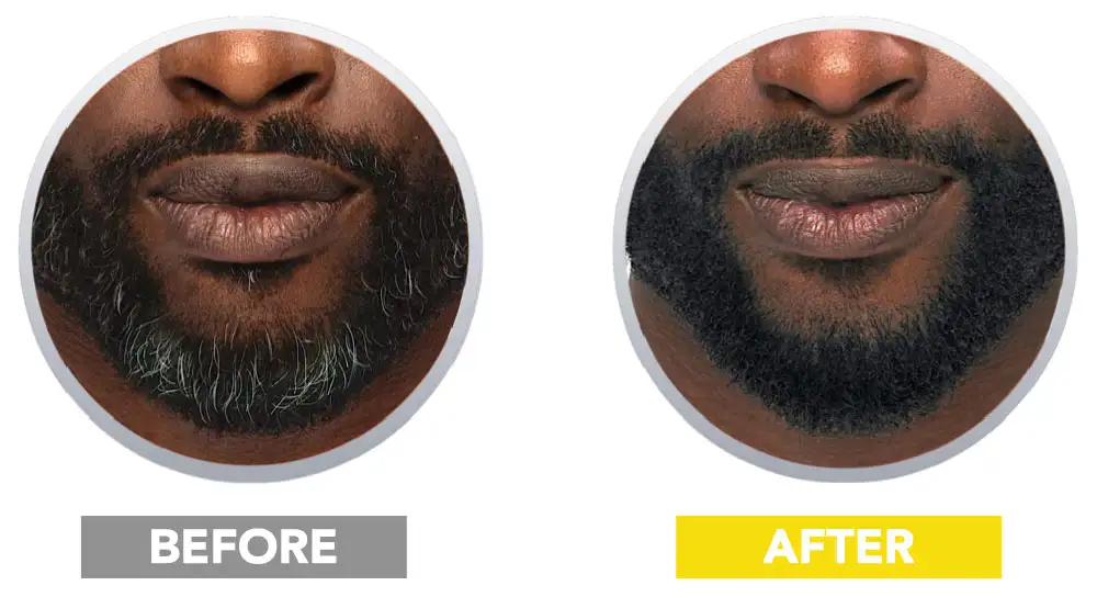 Before and after results of Cleverman partial beard dye for targeted gray coverage. Perfect for touch-ups, blending grays naturally in just 7 minutes. Easy application and better for sensitive skin.