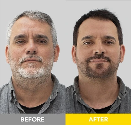 Men's dark brown hair and beard dye before and after. 5-star review for best gray coverage and rich, even color. Works fast and better than Just For Men.