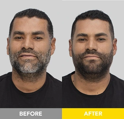 Before and after jet black hair and beard dye for men. 5-star review for long-lasting color, quick application, and a bold, natural look.