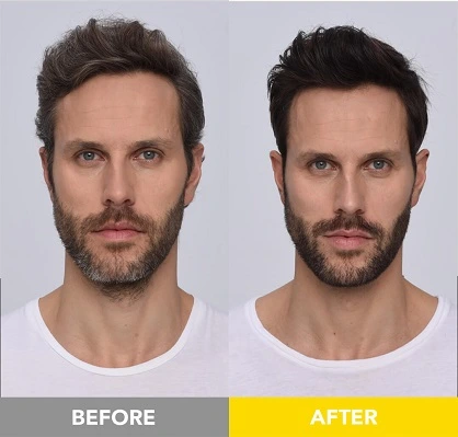 Men's soft black hair and beard dye before and after. 5-star review for gentle, irritation-free formula. Works fast and provides deep, rich color.